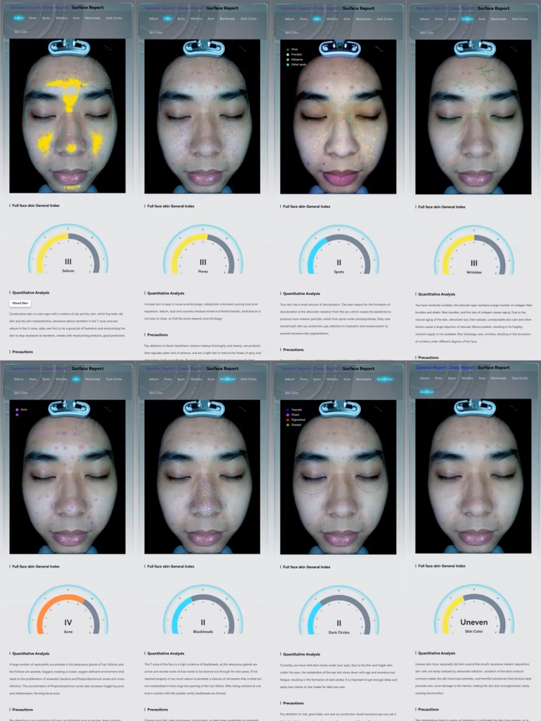 분석1